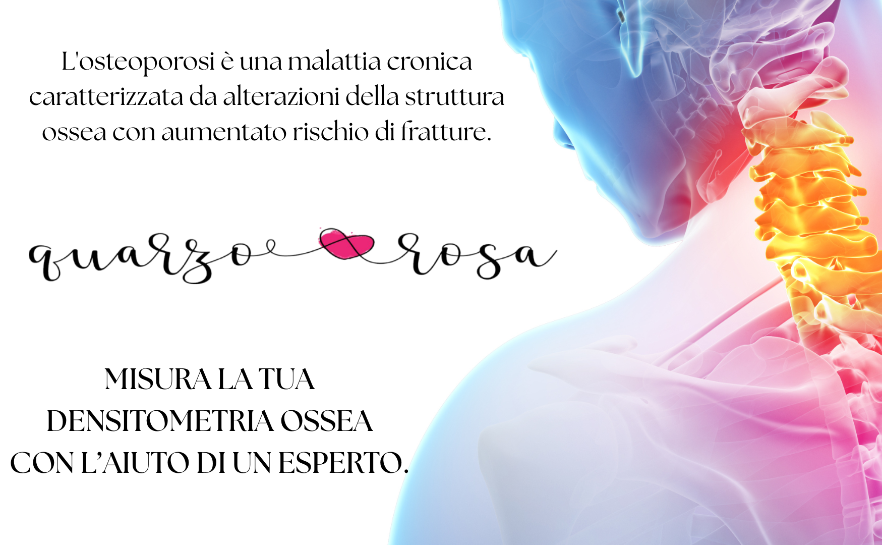 GIORNATA OSTEOPOROSI GIORNATA OSTEOPOROSI
